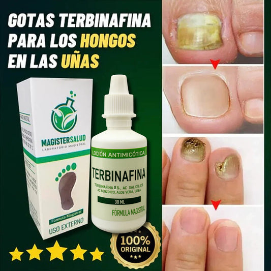 TERBINAFINA-UÑAS SANAS