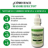 TERBINAFINA-UÑAS SANAS