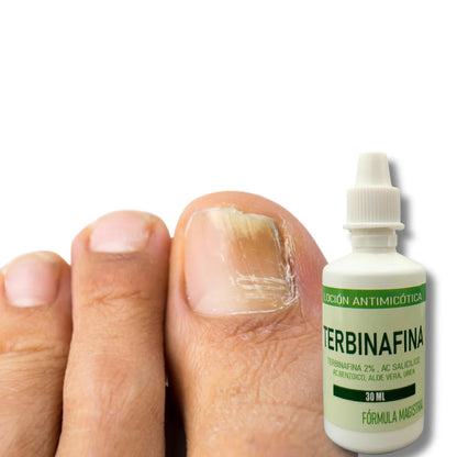 TERBINAFINA-UÑAS SANAS
