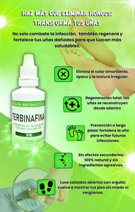 TERBINAFINA-UÑAS SANAS